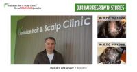 Australian Hair & Scalp Clinic (Aushair) image 2